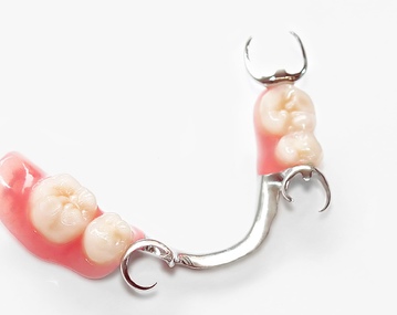 Протезирование зубов: Бюгельное, частично- и полностью съемное