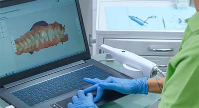 Врач рассматривать 3D-снимок челюсти пациента