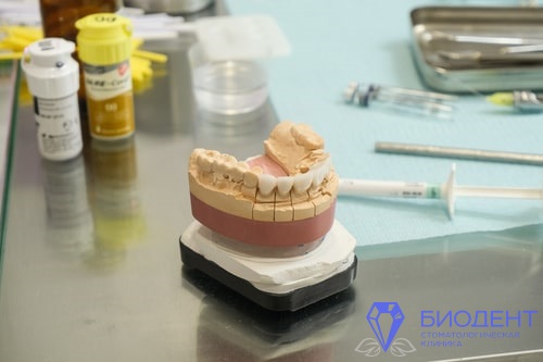 Зубные импланты на стендовой челюсти
